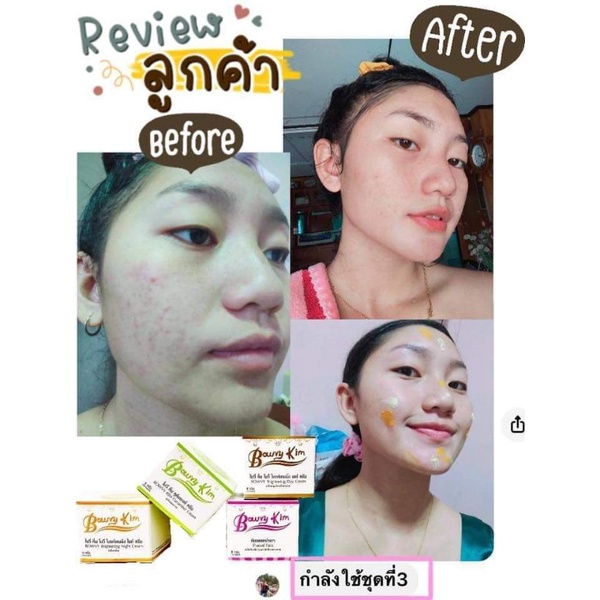 ครีมโบวี่คิ้ม-bowvy-kim-ลดสิว-ฝ้า-ผิวหมองคล้ำ-ให้ขาวกระจ่างใสแท้10000