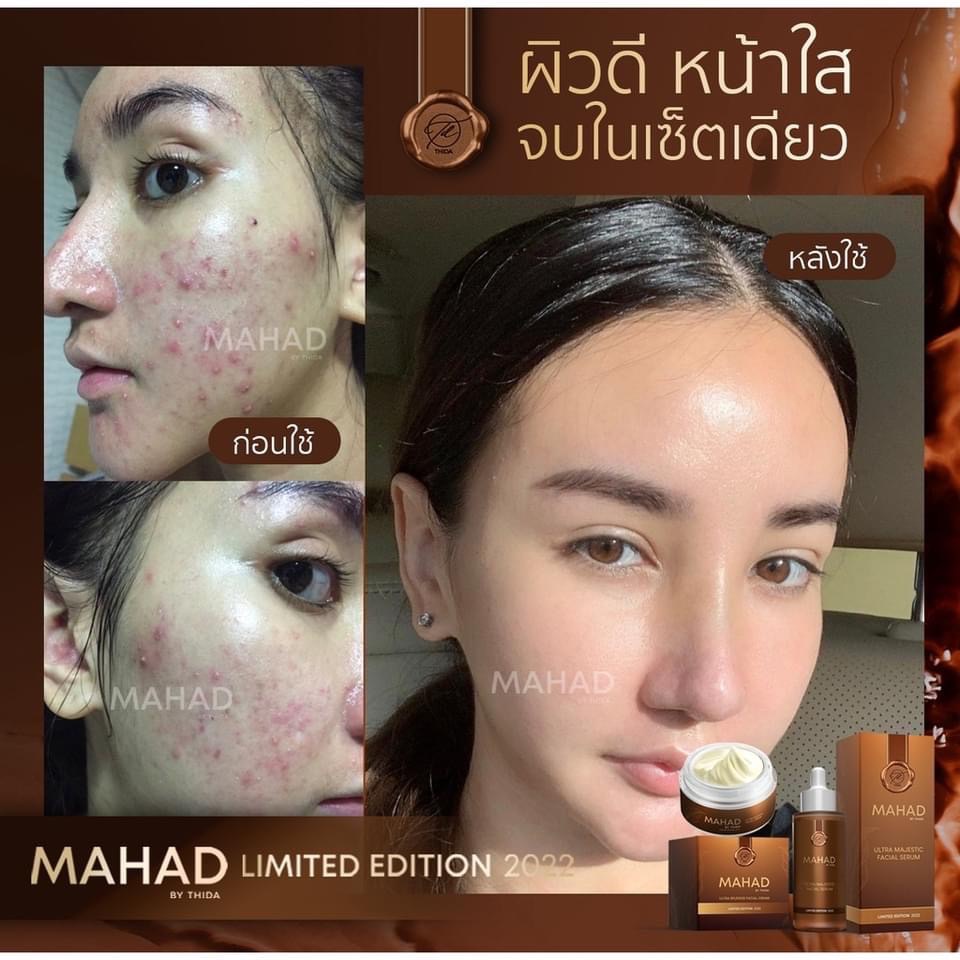 โฉมใหม่-เซรั่มมะหาด-ครีมมะหาด-บำรุงหน้า-mahad-facial-serum-by-thida-มะหาดบำรุงผิวกาย-mahad-body-serum