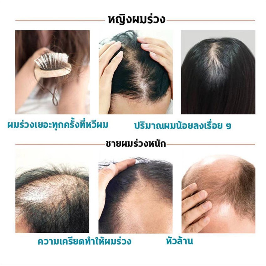 2-ขวด-แชมพูแก้ผมร่วง-เซรั่มยาสระผมขิง-500ml-30mlแก้ปัญหาผมร่วงต่างๆ-ปลูกผมให้ขึ้นใหม่-แชมพูแก้ปัญหาผมร่วง-แชมพูขิงเพียว