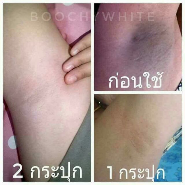 ครีมรักแร้ขาว-bootchy-white