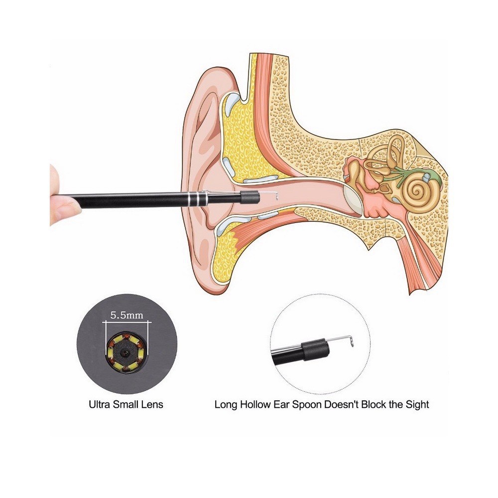 กล้องส่องตรวจหู-กล้องส่องหู-hd-visual-earwax-clean-tool-รุ่น-earwax06a-j1