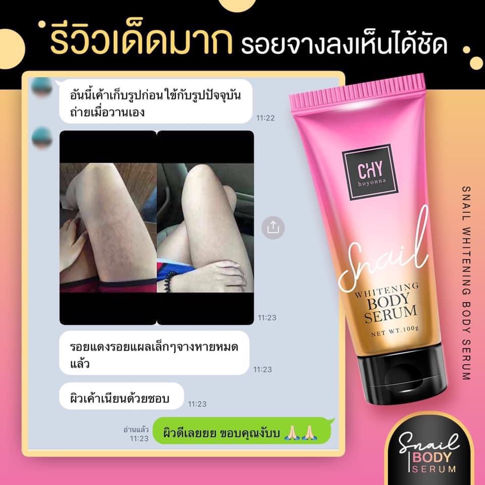 แท้พร้อมส่ง-ผิวดำ-ผิวคล้ำ-ผิวเเห้งแตกลายอร้ายยยยยย-ทำไงดี-นี้เลยจร้าเซรั่มบำรุงผิวที่กำลังโด่งดังมากในตอนนี้-สูตรล