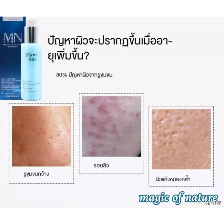 yiyan-รูขุมขนหดตัวสาระสำคัญ-120ml-รูขุมขนกระชับขึ้-เซรั่มกระชับใบหน้า-รูขุมขนหดตัว-เซรั่มไฮย