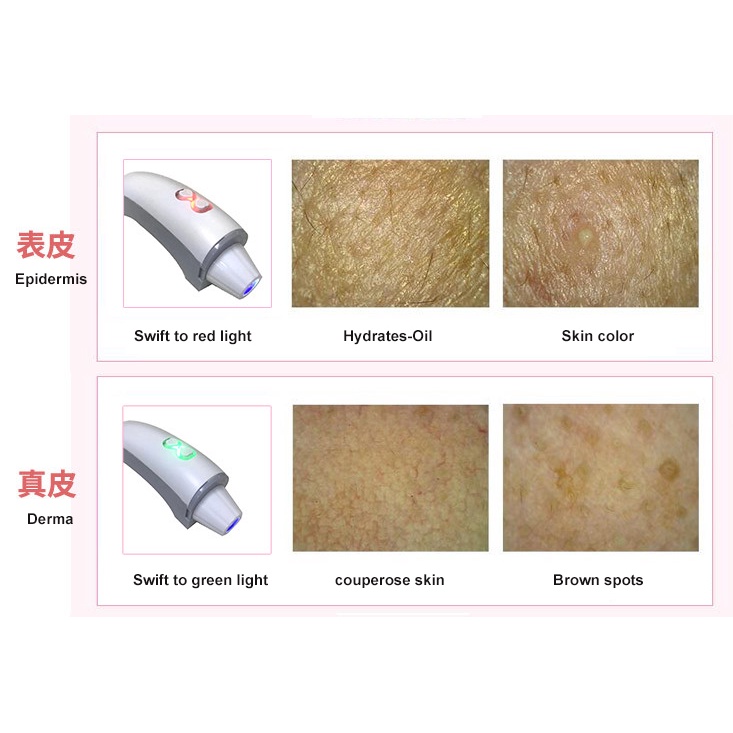 3d-skin-analyzer-high-resolution-skin-scanner-facial-skin-analyzer-skin-wrinkle-analyzer-color-acne-analysis-s