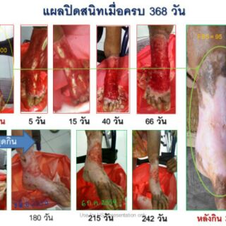 ภาพขนาดย่อของภาพหน้าปกสินค้าคาวตองuss พลูคาว กระตุ้นเสริมภูมิคุ้มกัน 60caps สูตรเข้มข้น จากร้าน spyspon บน Shopee ภาพที่ 5