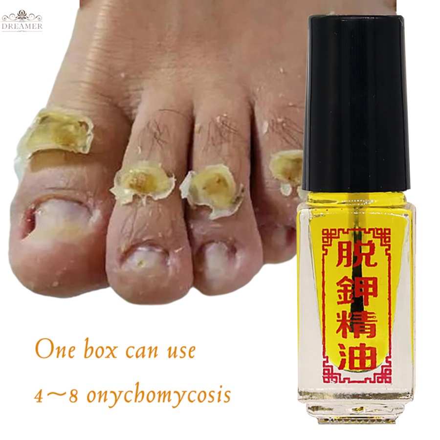 dreamer-new-3-days-effect-treatment-removal-of-onychomycosis-paronychia-anti-oil-fungal-nail-fungus-oil-care