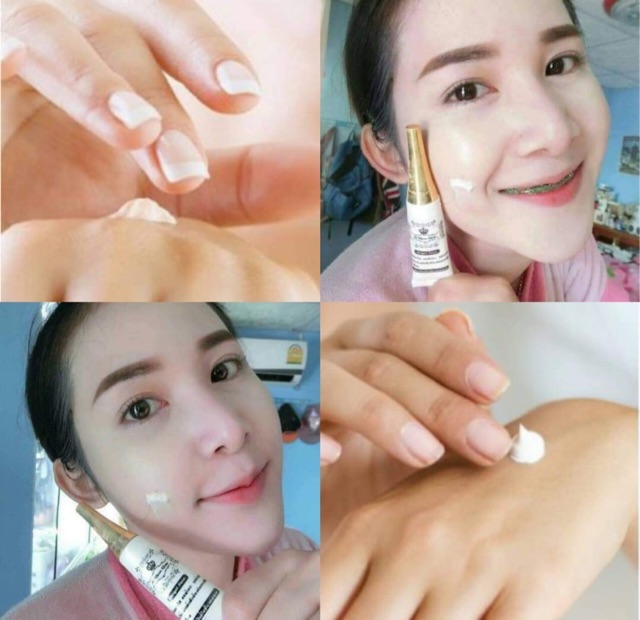 ครีมหน้าใส-angle-facial-cream-by-ab-khuenkhaw