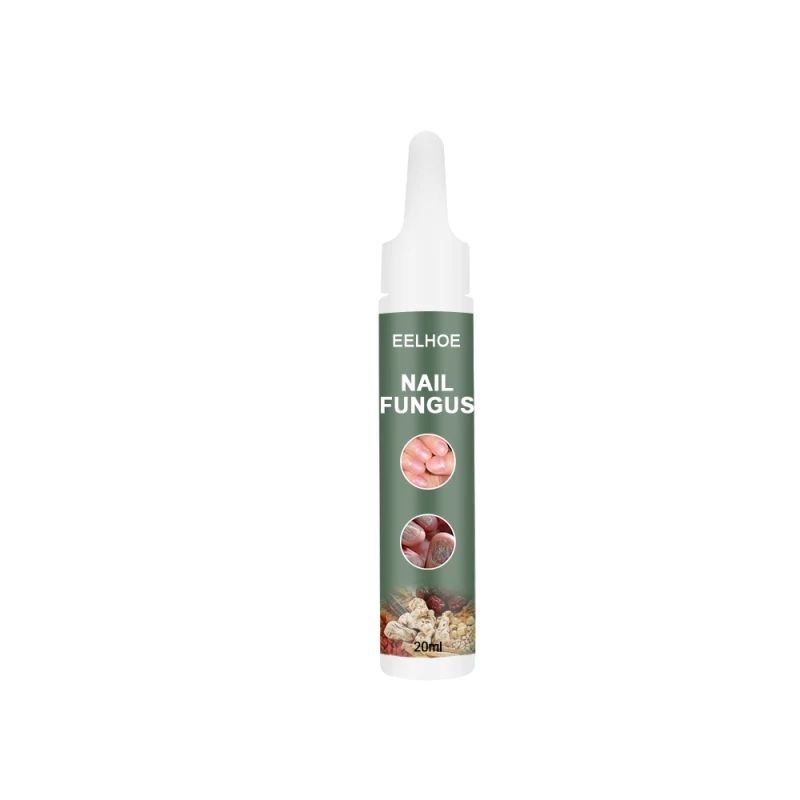 nail-fungus20ml-วิธีแก้ปัญหาการรักษาเชื้อราเล็บ-มือและเล็บเท้าที่แข็ง