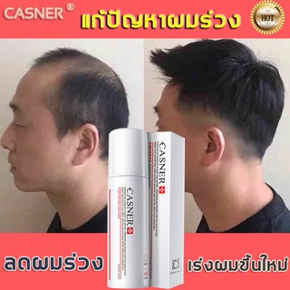 ภาพหน้าปกสินค้าCASNER น้ำยาปลูกผม ปลูกผม น้ำยาเร่งผมยาว เซรั่มปลูกผม น้ำยาปลูกผม เร่งผมขึ้นใหม่ เซรั่มบำรุงผม รักษาผม รักษาผมร่วง สเปรย ซึ่งคุณอาจชอบราคาและรีวิวของสินค้านี้