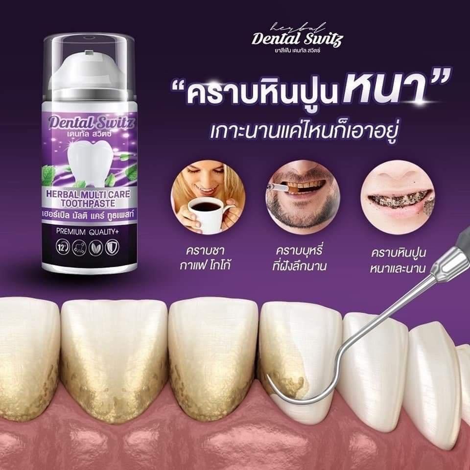 ของแท้-1-แถม-1-ยาสีฟัน-dental-switz-เจลฟอกฟันขาวสูตรเข้มข้น