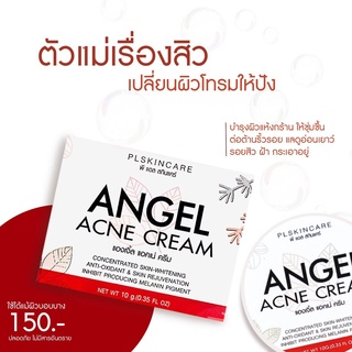 Angel Acne Cream : แองเจิ้ล แอคเน่ ครีม #เน้นลดสิว จบปัญหาสิว !!!