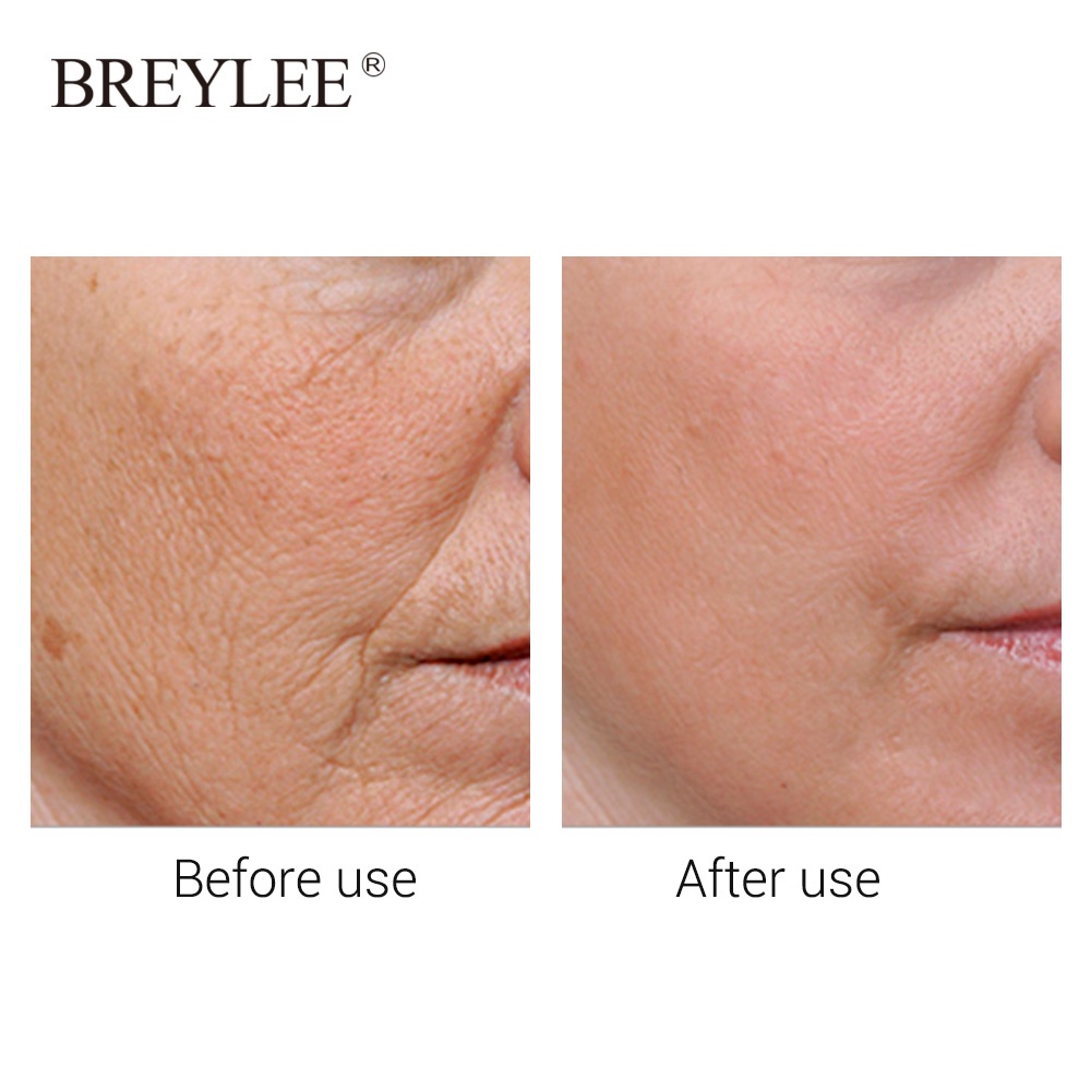 จัดส่งไว-breylee-เซรั่มคอลลาเจนทองคำ-24k-พอกหน้า-ให้ความชุ่มชื้น-ต่อต้านวัย-5-ชิ้น-anti-aging-anti-wrinkles-facial-mask