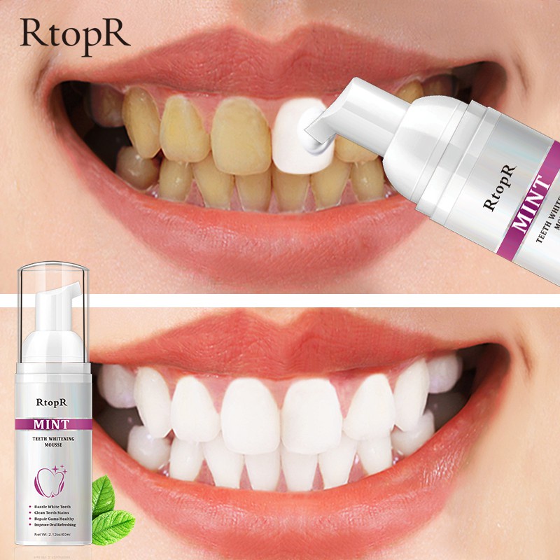 ส่งจากไทย-ยาสีฟันเนื้อมูส-rtopr-teeth-whitening-mousse-60ml-รหัส-85052-สูตรปรับฟันขาว-ขจัดฟันเหลือง-ลดครบหินปูน-ฟันเหล
