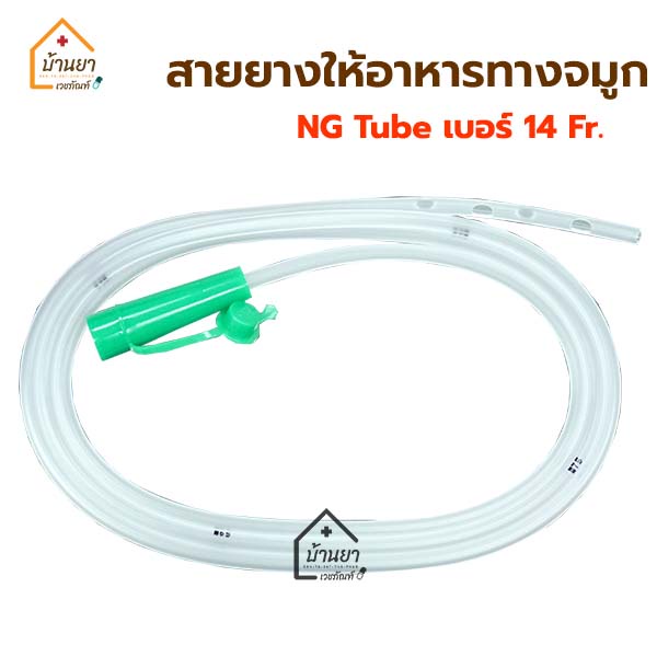 ng-tube-สายให้อาหารทางจมูก-สายสวนกระเพาะอาหาร-stomach-tube