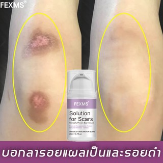 FEXMS ครีมลบแผลเป็น 20ML ครีมลดรอยแผล เจลลบรอยแผลเป็น ครีมทาแผลเป็น ครีมลบรอยแผลเป็น แผลน้ำร้อนลวก ครีมลดรอยสิว