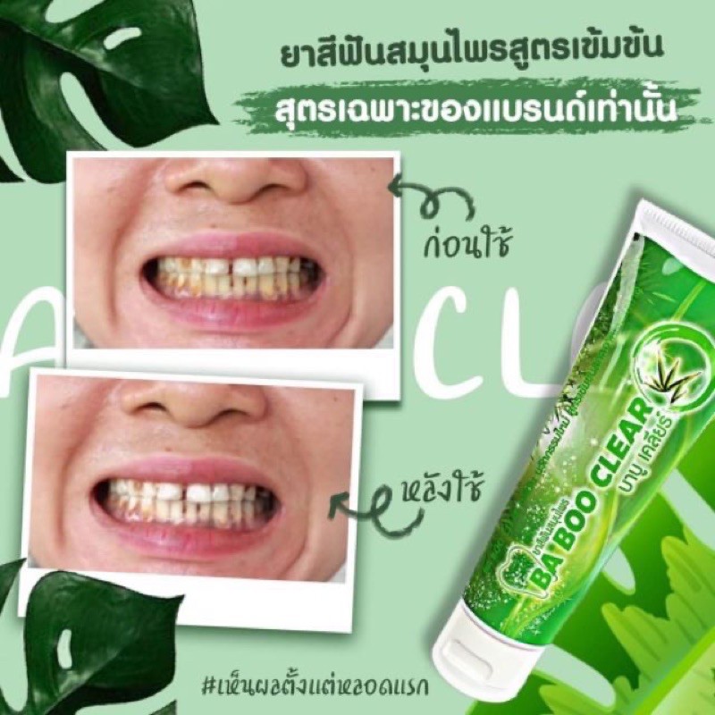 ภาพสินค้ายาสีฟันบาบูเคลียร์ Ba Boo Clear ยาสีฟันสมุนไพร (120g.) จากร้าน 2ur_cosmetic บน Shopee ภาพที่ 1