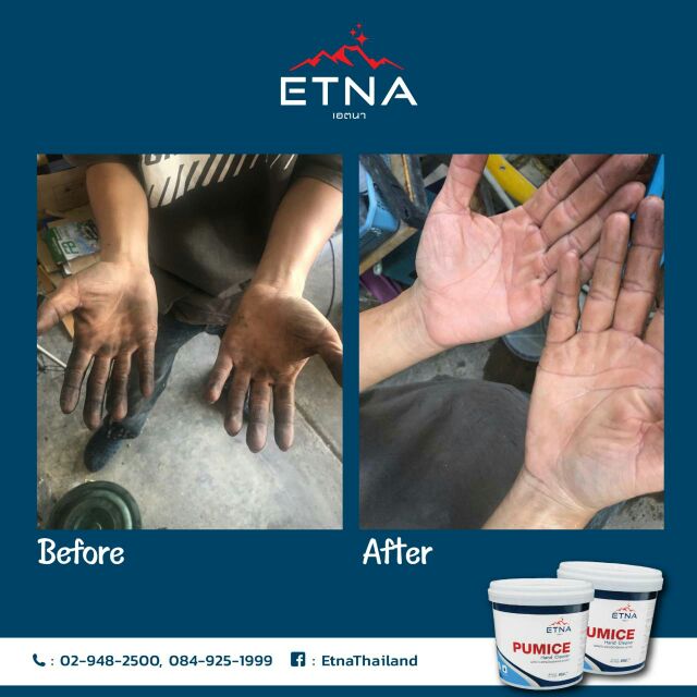 โปร-1แถม1-ผงล้างมือ-etna-ผลิตภัณฑ์ล้างมือขจัดคราบสกปรก