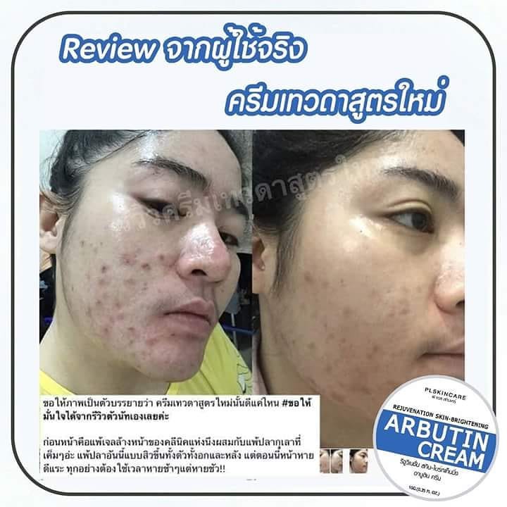 ครีมเทวดา-สูตรใหม่-rejuvenation-skin