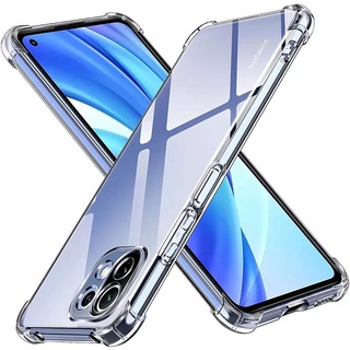 [ เคสใสพร้อมส่ง ] Case Xiaomi Mi 11Lite เคสโทรศัพท์ เสี่ยวมี เคสใส เคสกันกระแทก case xiaomi mi11lite