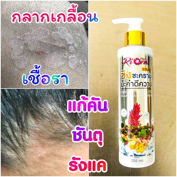 แชมพู-ริโอร่า-riora-ขิงชะครามมะคำ-แชมพูสูตรโบราณ-สำหรับคันศีรษะ-รังแค-ชันตุ-กลากเกลื้อน-เชื้อรา-บนหนังศีรษะ