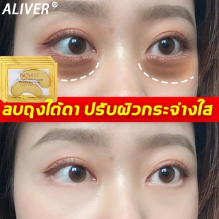 ALIVER มาร์คใต้ตาทองคำ 5เม็ด ผิวรอบดวงตากระจ่างใส ลดรอยตีนกา ลดถุงใต้ตา สูตรผสมคอลลาเจน มาร์กคอลลาเจน บำรุงใต้ตาคล้ำ