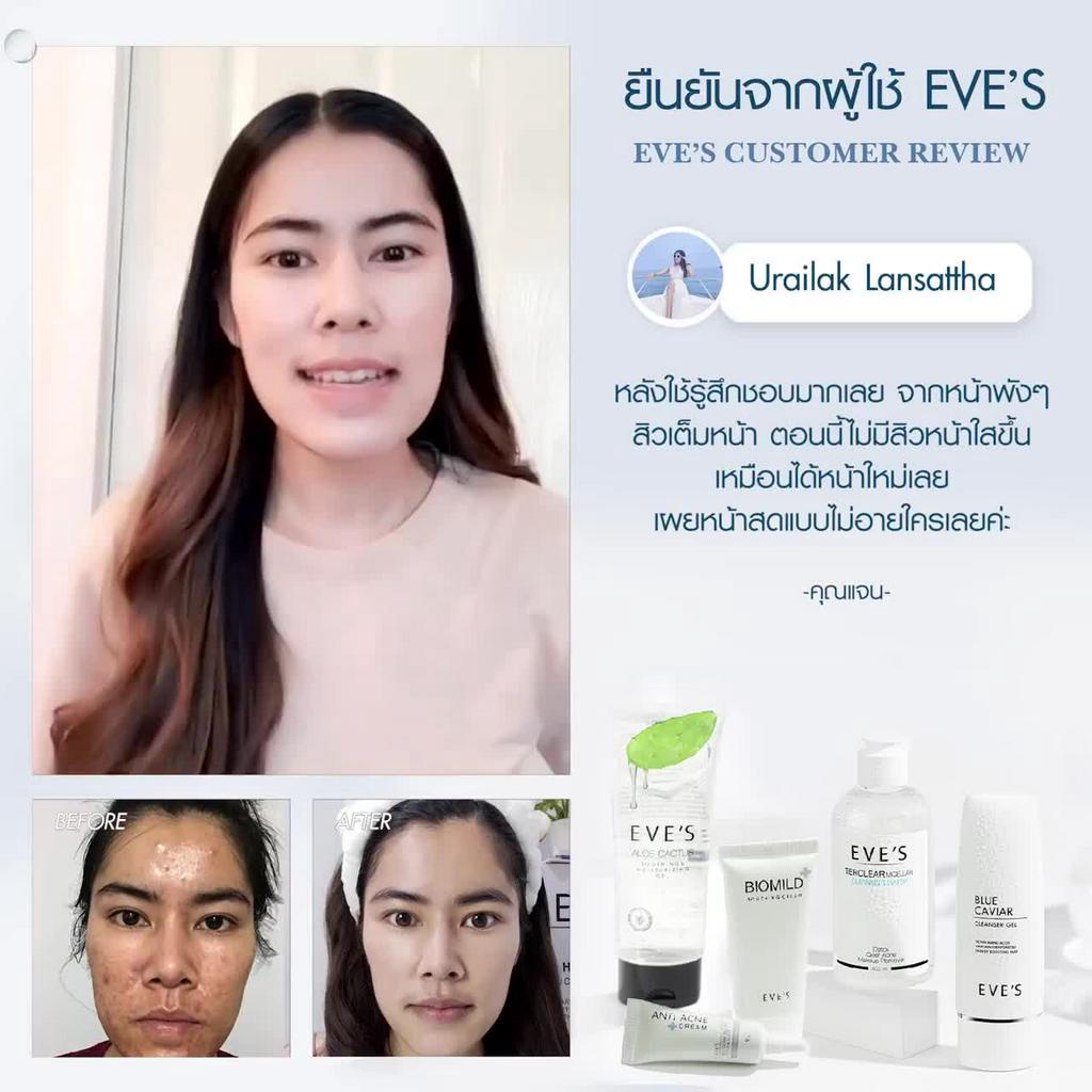 eves-เซตปราบสิวผิวผิวติดสาร-ปรับผิวให้ชุ่มชื่น-และกลับมาแข็งแรง