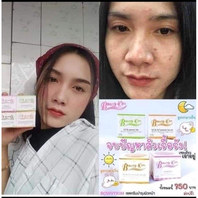 ครีมโบวี่คิ้ม-bowvy-kim-ลดสิว-ฝ้า-ผิวหมองคล้ำ-ให้ขาวกระจ่างใสแท้10000