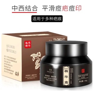 Zhenxiu deep moisturizing ครีมบำรุงผิวลดรอยแผลแตกลาย