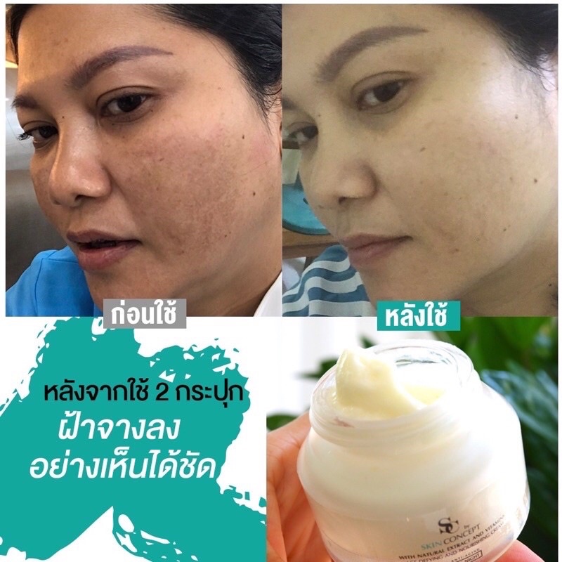 sc-by-skin-concept-ครีมแก้ฝ้า-ครีมลดฝ้าหน้ากระจ่างใส