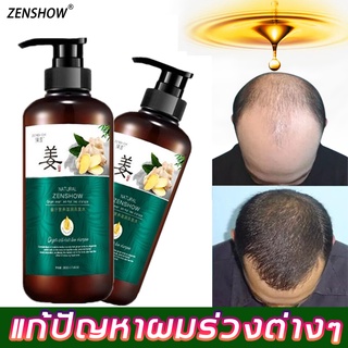 สินค้า Zhenshow ขิง แคร์คอมโบ ให้ผมหนาขึ้น ป้องกันผมร่วง  แชมพูป้องกันผมร่วง  แชมพูปลูกผม ปลูกผม ความลับ