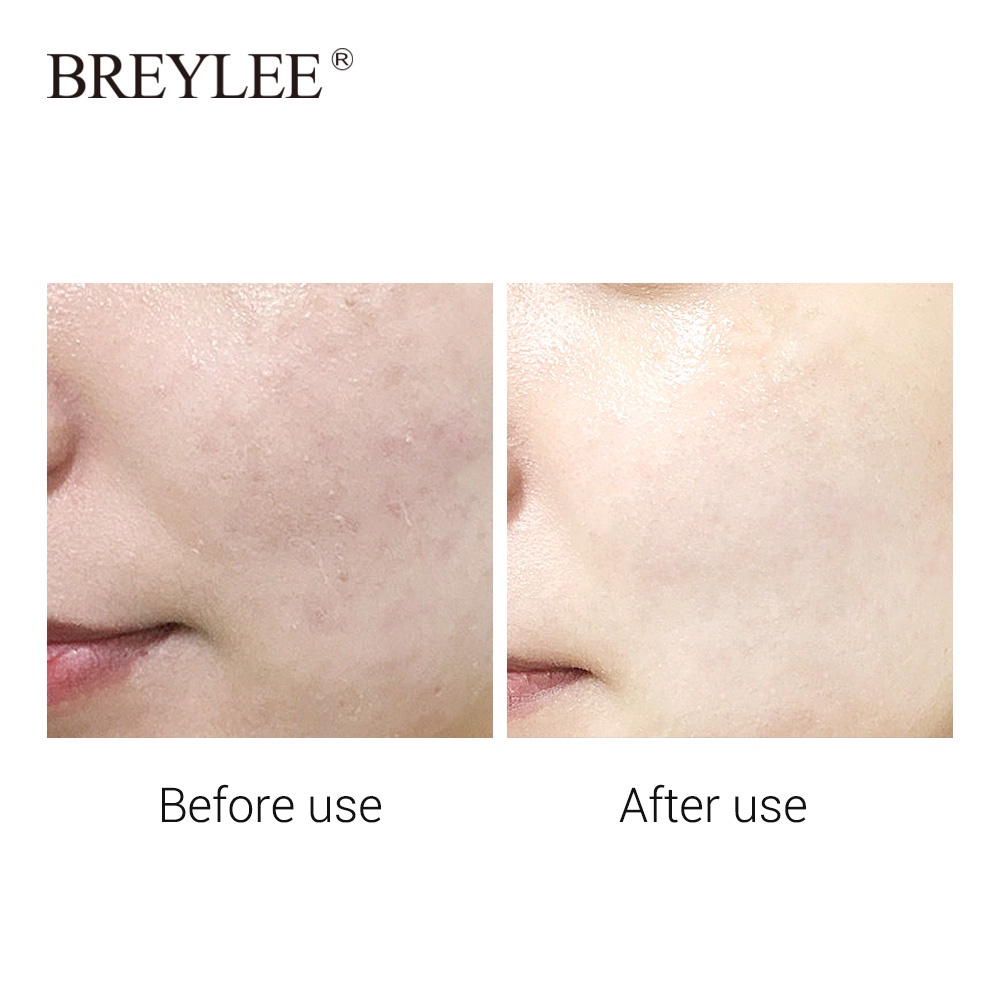 breylee-hyaluronic-acid-เซรั่มบํารุงผิวหน้าให้ความชุ่มชื้นลดริ้วรอย-25มล-10ชิ้น