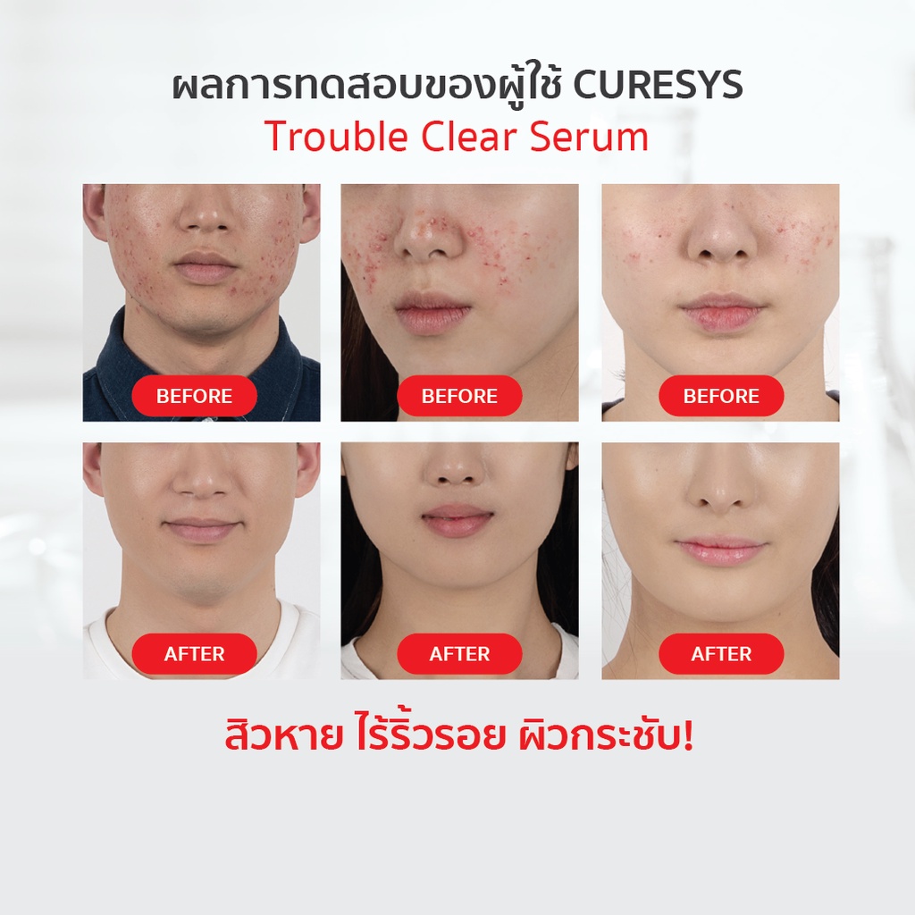 ภาพสินค้า(ของแท้ 100% ฉลากไทย) Curesys Trouble clear serum 30ml. จากร้าน evalavie.cosmetics บน Shopee ภาพที่ 1