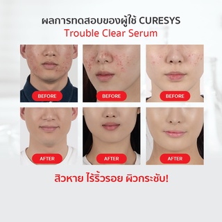 ภาพขนาดย่อของภาพหน้าปกสินค้า(ของแท้ 100% ฉลากไทย) Curesys Trouble clear serum 30ml. จากร้าน evalavie.cosmetics บน Shopee ภาพที่ 1