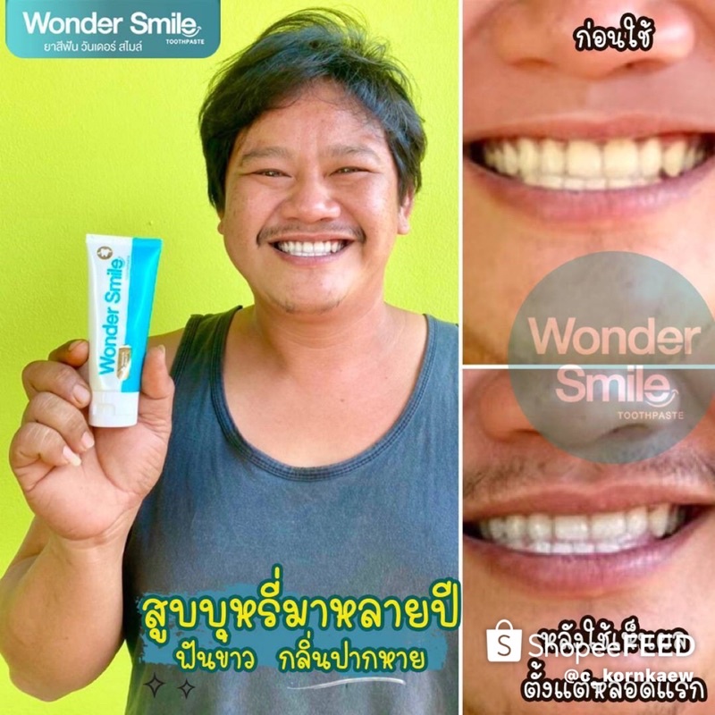 ยาสีฟันwonder-smile-ขนาด-80-กรัม