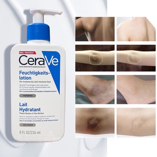 CeraVe Whitening Cream Moisturizing Nourish Repair Improve Arm Armpit Ankles Elbow Knee Body Dull Brighten Arbutin Skin