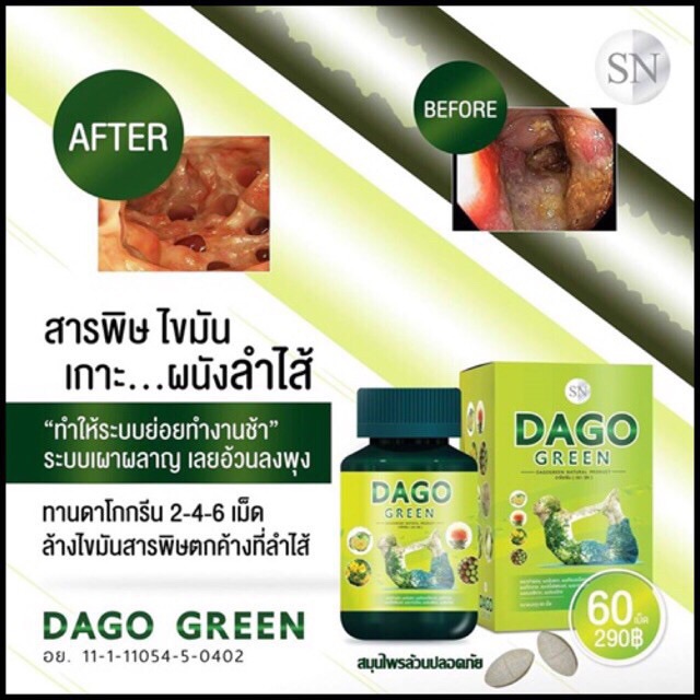 dago-green-ดาโกกรีน-สมุนไพรลดหน้าท้อง