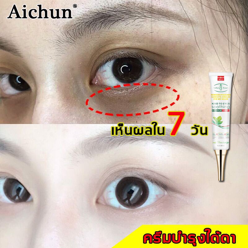 ส่งจากไทย-aichun-อายครีม-ครีมรอบดวงตา30ml-สามารถลดถุงใต้ตา-ขอบตาดำ-แบ่งเบาริ้วรอย-ลดใต้ตาดำ-ครีมลดใต้ตาดํา-รหัส505033