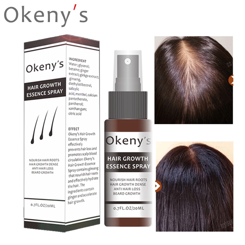 okenys-hair-growth-essence-spray-ป้องกันศีรษะล้านป้องกันผมร่วงบำรุง