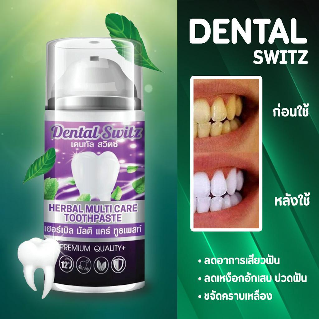 ขายดีที่สุด-dental-switz-เจลฟอกฟันขาว-ยาสีฟันฟอกฟันขาว-dentalswitz-ลดคราบฟันเฟลือง-หินปูน-กลิ่นปาก-เหงือกบวม-เสียวฟัน