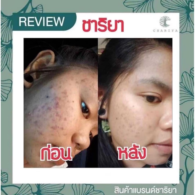 ส่งฟรี-เซทหน้าใส-สบู่ใบบัวบก-เซรั่มคอลลาเจน-ครีมชาริยา-ชาริยาสกินแคร์-ลดสิว-สิวอักเสบ-สิวทุกชนิด-ลดรอยสิว-ลดจุดด่างดำ