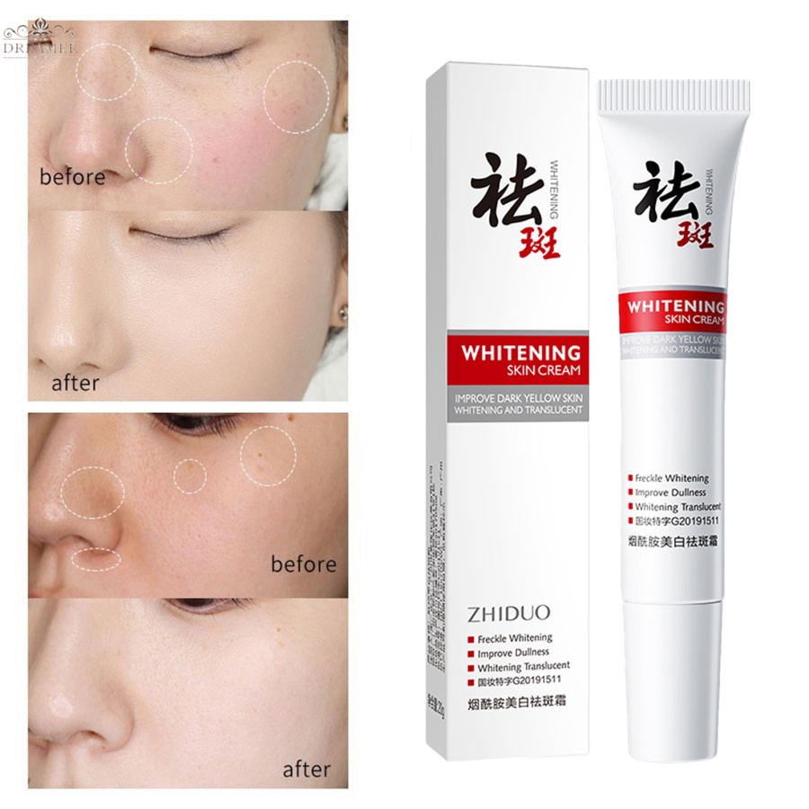 dreamer-dark-spot-corrector-cream-whitening-freckle-cream-removing-melasma-pigmentation-moisturizing-skin-care
