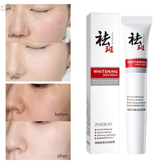 【DREAMER】Dark Spot Corrector Cream Whitening Freckle Cream Removing Melasma Pigmentation Moisturizing Skin Care