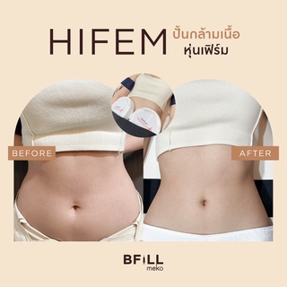 ภาพขนาดย่อของภาพหน้าปกสินค้าHIFEM Sculpt Unlimited ปั้นกล้ามเนื้อ หุ่นเฟิร์ม คอร์สเร่งด่วน ทำบ่อย ทำต่อเนื่อง จากร้าน mekobfillclinic บน Shopee