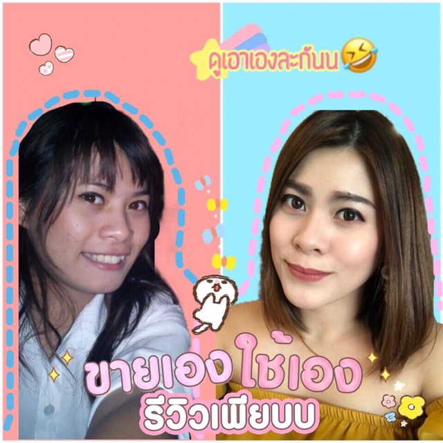 ครีมรักษาสิวลาเบลล่าครีม-หน้าใสขึ้น-ลดรอยดำจากสิวอักเสบ-ช่วยบำรุงผิวหน้าให้ใส