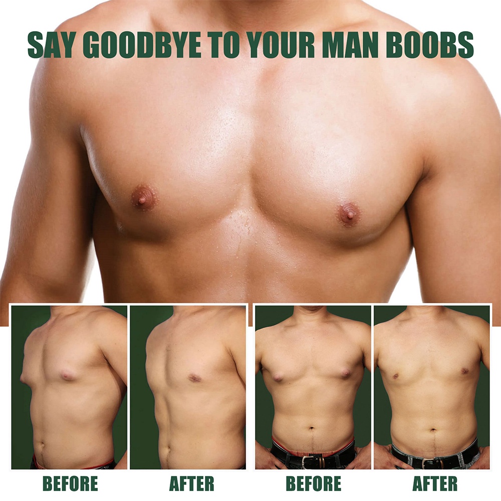 agdoad-gynecomastia-ครีมขิงกระชับสัดส่วน-ต่อต้านเซลลูไลท์-จากพืชธรรมชาติ-ครีมนวดกระชับหน้าอก-ครีมขิงกระชับสัดส่วน-ครีมลดไขมันส่วนเกิน-ครีมขยายเต้านม