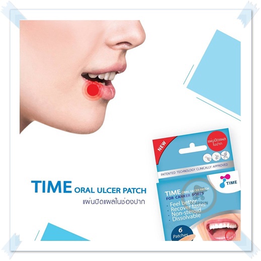 ภาพสินค้าTime Oral Ulcer Patch แผ่นปิดแผลในปาก (1ซอง มี2ชิ้น) ละลายในปาก รักษาร้อนใน จากร้าน bearrun.1 บน Shopee ภาพที่ 1