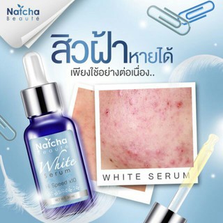 แท้/ถูก/ส่งไว 🔥🔥พร้อมส่งจ้า 🔥🔥 เซรั่มสลายฝ้าณัชชา(พร้อมส่งฟรี!)Natcha30ml.