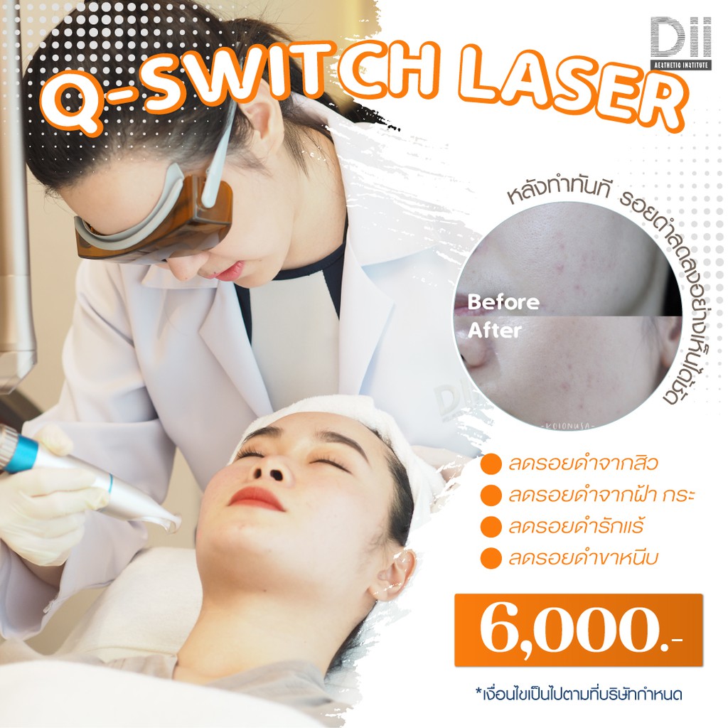 ภาพหน้าปกสินค้าDii Aesthetic : Q-Switch Laser 1 Time จากร้าน dii_aesthetic บน Shopee