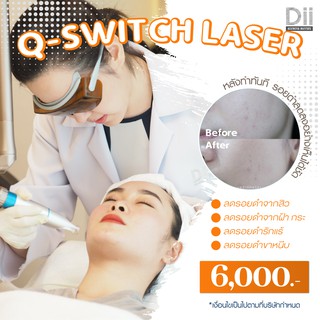 ภาพขนาดย่อของภาพหน้าปกสินค้าDii Aesthetic : Q-Switch Laser 1 Time จากร้าน dii_aesthetic บน Shopee