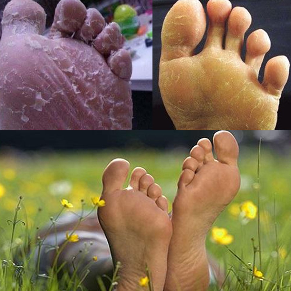 สมุนไพรแช่เท้า-สมุนไพรอัดเม็ดละลายน้ำแช่เท้ารักษาเชื้อรา-เชื้อแบคทีเรีย-โรคเท้าทุกชนิด